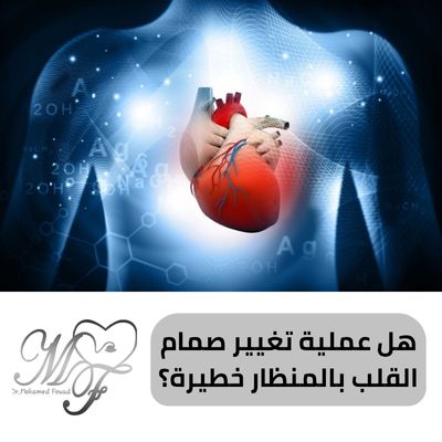 هل عملية تغيير صمام القلب بالمنظار خطيرة | انتبه الى 4 علامات للخطورة