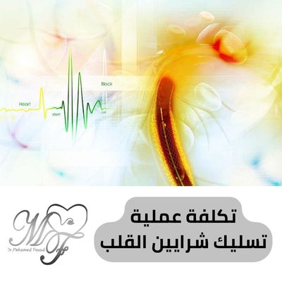 تكلفة عملية تسليك شرايين القلب 2025