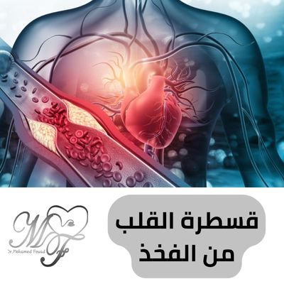قسطرة القلب من الفخذ 2025